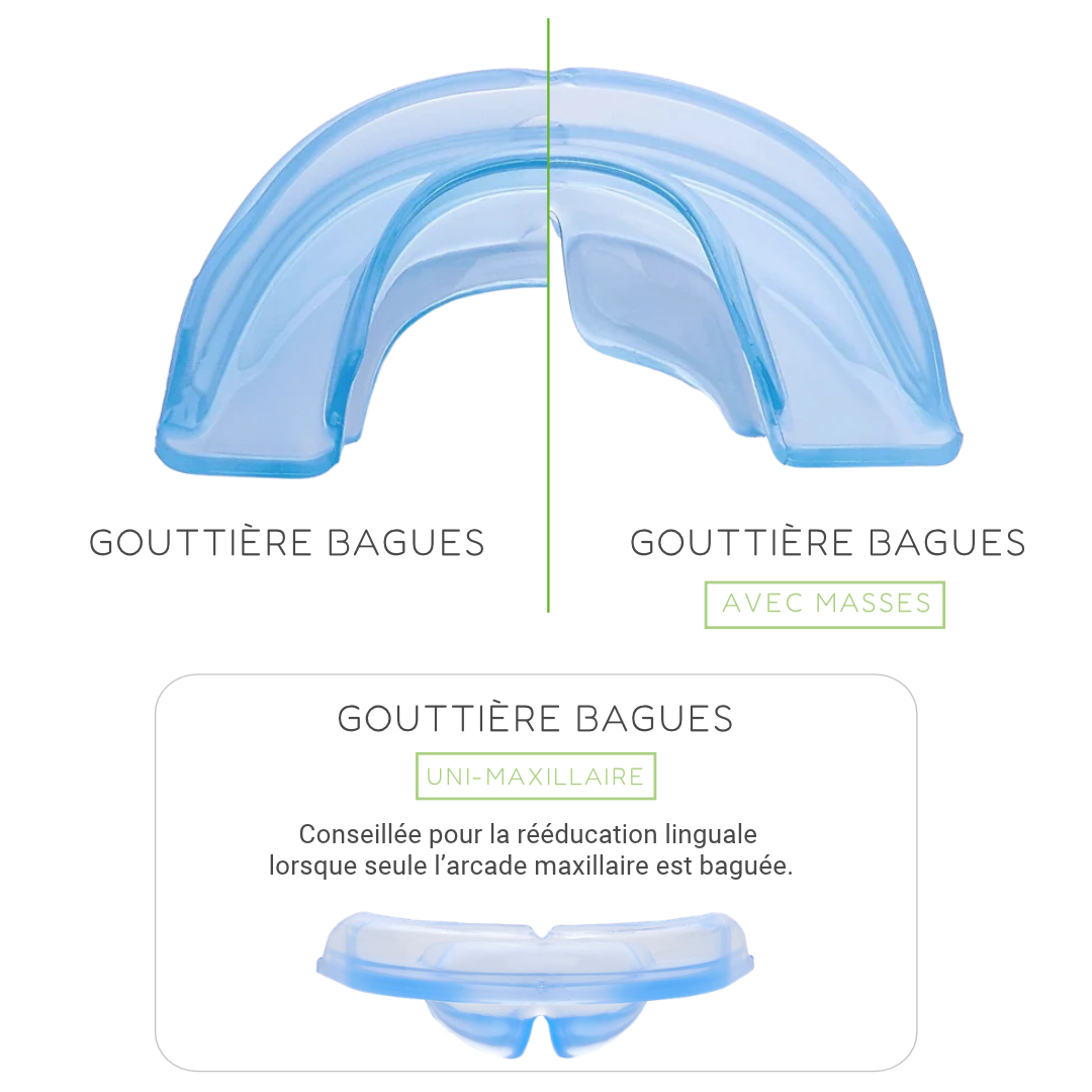 Gouttières bagues schéma